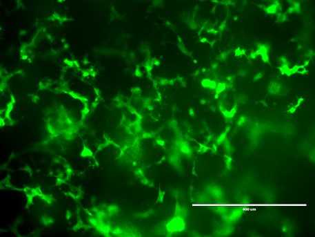 Fig 1. Microscope image of a 5 day old fine network of blood vessels grown in a scaffold composed of a hydrogel derived from skin (Harmsen lab) – intended to develop a new repair system to treat skin damage such as diabetic ulcers.